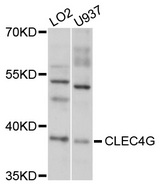 CLEC4G Antibody - Western blot analysis of extracts of various cell lines, using CLEC4G antibody at 1:1000 dilution. The secondary antibody used was an HRP Goat Anti-Rabbit IgG (H+L) at 1:10000 dilution. Lysates were loaded 25ug per lane and 3% nonfat dry milk in TBST was used for blocking. An ECL Kit was used for detection and the exposure time was 90s.