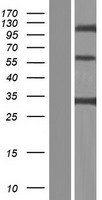 CLEC4G Protein - Western validation with an anti-DDK antibody * L: Control HEK293 lysate R: Over-expression lysate