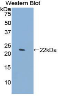 CLEC4M / L-SIGN / CD299 Antibody - Western blot of recombinant CLEC4M / L-SIGN / CD299.