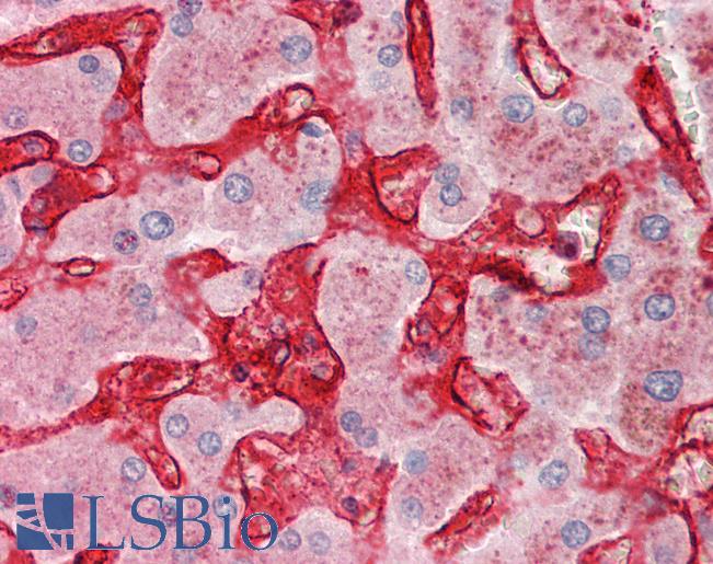 CLEC4M / L-SIGN / CD299 Antibody - Anti-CLEC4M / L-SIGN / CD299 antibody IHC staining of human liver. Immunohistochemistry of formalin-fixed, paraffin-embedded tissue after heat-induced antigen retrieval. Antibody concentration 10 ug/ml.  This image was taken for the unconjugated form of this product. Other forms have not been tested.
