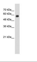 CLEC4M / L-SIGN / CD299 Antibody - HepG2 Cell Lysate.  This image was taken for the unconjugated form of this product. Other forms have not been tested.