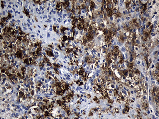 CLEC4M / L-SIGN / CD299 Antibody - Immunohistochemical staining of paraffin-embedded Human Ovary tissue within the normal limits using anti-CLEC4M mouse monoclonal antibody. (Heat-induced epitope retrieval by 1mM EDTA in 10mM Tris buffer. (pH8.5) at 120°C for 3 min. (1:150)