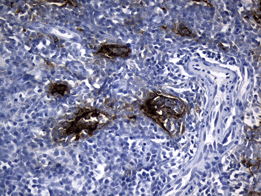 CLEC4M / L-SIGN / CD299 Antibody - Immunohistochemical staining of paraffin-embedded Human lymph node tissue within the normal limits using anti-CLEC4M mouse monoclonal antibody. (Heat-induced epitope retrieval by 1mM EDTA in 10mM Tris buffer. (pH8.5) at 120°C for 3 min. (1:150)