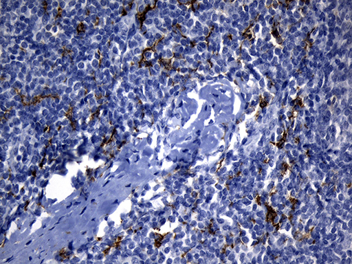 CLEC4M / L-SIGN / CD299 Antibody - Immunohistochemical staining of paraffin-embedded Human tonsil within the normal limits using anti-CLEC4M mouse monoclonal antibody. (Heat-induced epitope retrieval by 1mM EDTA in 10mM Tris buffer. (pH8.5) at 120°C for 3 min. (1:150)
