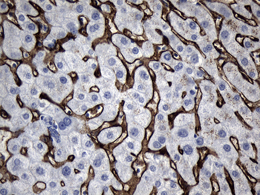 CLEC4M / L-SIGN / CD299 Antibody - Immunohistochemical staining of paraffin-embedded Human liver tissue within the normal limits using anti-CLEC4M mouse monoclonal antibody. (Heat-induced epitope retrieval by 1mM EDTA in 10mM Tris buffer. (pH8.5) at 120°C for 3 min. (1:150)