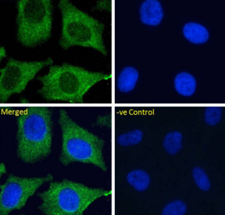 CLEC4M / L-SIGN / CD299 Antibody - IF staining of HeLa cells.