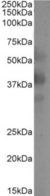 CLEC4M / L-SIGN / CD299 Antibody - IF staining of HeLa cells.