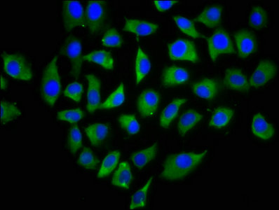 CLEC4M / L-SIGN / CD299 Antibody - Immunofluorescence staining of A549 cells with CLEC4M Antibody at 1:166, counter-stained with DAPI. The cells were fixed in 4% formaldehyde, permeabilized using 0.2% Triton X-100 and blocked in 10% normal Goat Serum. The cells were then incubated with the antibody overnight at 4°C. The secondary antibody was Alexa Fluor 488-congugated AffiniPure Goat Anti-Rabbit IgG(H+L).