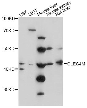 CLEC4M / L-SIGN / CD299 Antibody - Western blot analysis of extracts of various cell lines, using CLEC4M antibody at 1:3000 dilution. The secondary antibody used was an HRP Goat Anti-Rabbit IgG (H+L) at 1:10000 dilution. Lysates were loaded 25ug per lane and 3% nonfat dry milk in TBST was used for blocking. An ECL Kit was used for detection and the exposure time was 90s.