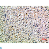 CLEC4M / L-SIGN / CD299 Antibody - Immunohistochemical analysis of paraffin-embedded human-liver, antibody was diluted at 1:200.