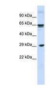 CLEC4M / L-SIGN / CD299 Antibody - CLEC4M / CD299 antibody Western blot of Fetal Muscle lysate. This image was taken for the unconjugated form of this product. Other forms have not been tested.