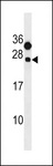 CLEC6A / Dectin 2 Antibody - CLEC6A Antibody western blot of human placenta tissue lysates (35 ug/lane). The CLEC6A antibody detected the CLEC6A protein (arrow).
