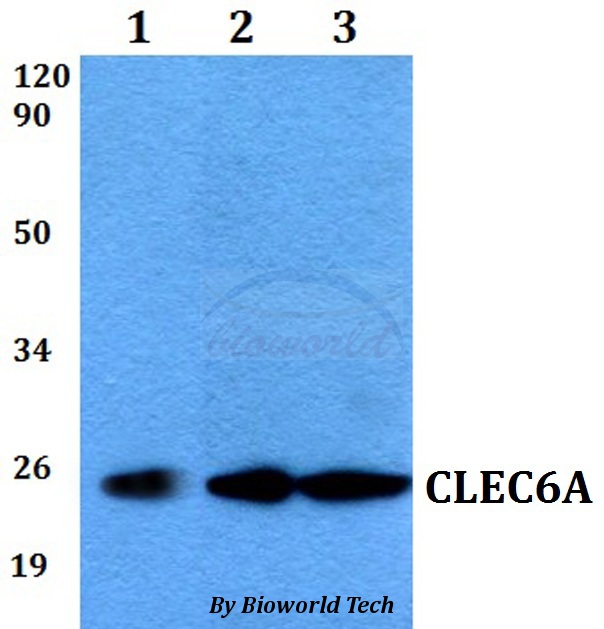 CLEC6A / Dectin 2 Antibody - Western blot of CLEC6A antibody at 1:500 dilution. Lane 1: MCF-7 whole cell lysate. Lane 2: sp2/0 whole cell lysate. Lane 3: PC12 whole cell lysate.