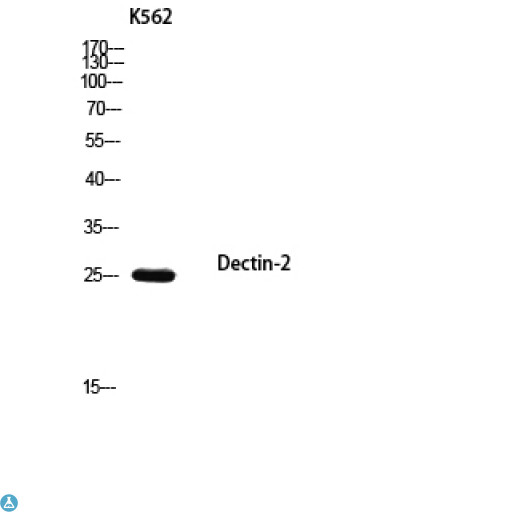CLEC6A / Dectin 2 Antibody - Western Blot (WB) analysis of SH-SY5Y 293T using Dectin-2 antibody.