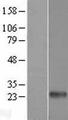 CLEC6A / Dectin 2 Protein - Western validation with an anti-DDK antibody * L: Control HEK293 lysate R: Over-expression lysate