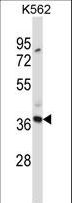 CLEC7A / Dectin 1 Antibody - CLEC7A Antibody western blot of K562 cell line lysates (35 ug/lane). The CLEC7A antibody detected the CLEC7A protein (arrow).