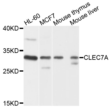 CLEC7A / Dectin 1 Antibody - Western blot analysis of extracts of various cells.