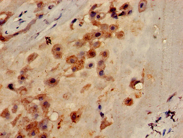 CLEC7A / Dectin 1 Antibody - Immunohistochemistry of paraffin-embedded human placenta tissue using CLEC7A Antibody at dilution of 1:100