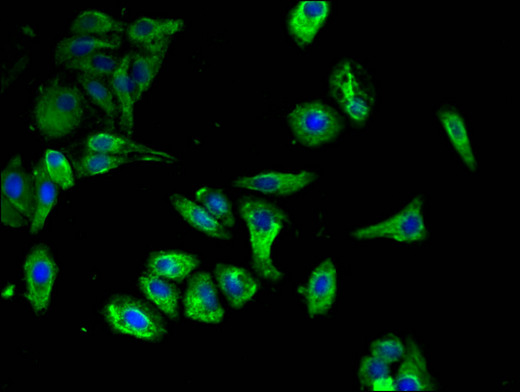 CLEC7A / Dectin 1 Antibody - Immunofluorescent analysis of HepG2 cells using CLEC7A Antibody at a dilution of 1:100 and Alexa Fluor 488-congugated AffiniPure Goat Anti-Rabbit IgG(H+L)