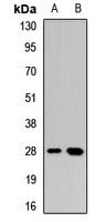 CLEC7A / Dectin 1 Antibody