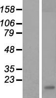 CLEC7A / Dectin 1 Protein - Western validation with an anti-DDK antibody * L: Control HEK293 lysate R: Over-expression lysate