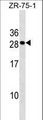 CLEC9A Antibody - CLEC9A Antibody western blot of ZR-75-1 cell line lysates (35 ug/lane). The CLEC9A antibody detected the CLEC9A protein (arrow).