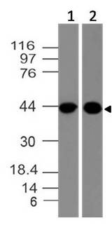CLEC9A Antibody - Fig-1: Western blot analysis of ClEC9A. Anti-ClEC9A antibody was used at 2 µg/ml on THP-1 and A431 lysates.
