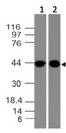 CLEC9A Antibody - Fig-1: Western blot analysis of ClEC9A. Anti-ClEC9A antibody was used at 2 µg/ml on THP-1 and A431 lysates.