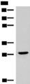 CLEC9A Antibody - Western blot analysis of Human fetal brain tissue lysate  using CLEC9A Polyclonal Antibody at dilution of 1:800