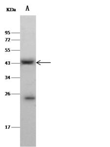CLEC9A Antibody - Anti-CLEC9A rabbit polyclonal antibody at 1:500 dilution. Lane A: MCF7 Whole Cell Lysate. Lysates/proteins at 30 ug per lane. Secondary: Goat Anti-Rabbit IgG (H+L)/HRP at 1/10000 dilution. Developed using the ECL technique. Performed under reducing conditions. Predicted band size: 27 kDa. Observed band size: 43 kDa.
