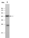 CLEC9A Antibody - Anti-CLEC9A rabbit polyclonal antibody at 1:500 dilution. Lane A: MCF7 Whole Cell Lysate. Lysates/proteins at 30 ug per lane. Secondary: Goat Anti-Rabbit IgG (H+L)/HRP at 1/10000 dilution. Developed using the ECL technique. Performed under reducing conditions. Predicted band size: 27 kDa. Observed band size: 43 kDa.