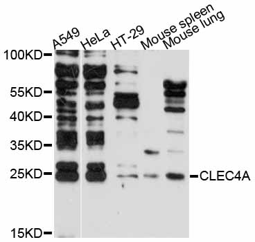 CLECSF6 / DCIR Antibody - Western blot analysis of extracts of various cell lines.