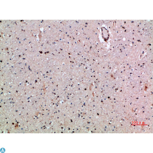 CLECSF6 / DCIR Antibody - Immunohistochemical analysis of paraffin-embedded human-brain, antibody was diluted at 1:200.