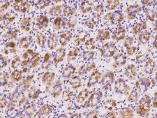 CLECSF6 / DCIR Antibody - Immunochemical staining of human CLEC4A in human stomach with rabbit polyclonal antibody at 1:500 dilution, formalin-fixed paraffin embedded sections.