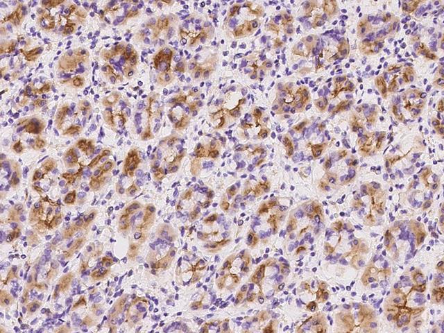 CLECSF6 / DCIR Antibody - Immunochemical staining of human CLEC4A in human stomach with rabbit polyclonal antibody at 1:500 dilution, formalin-fixed paraffin embedded sections.