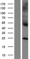 CLECSF6 / DCIR Protein - Western validation with an anti-DDK antibody * L: Control HEK293 lysate R: Over-expression lysate