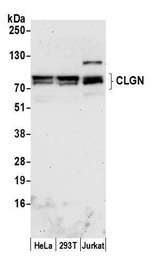 CLGN / Calmegin Antibody - Detection of human CLGN by western blot. Samples: Whole cell lysate (50 µg) from HeLa, HEK293T, and Jurkat cells prepared using NETN lysis buffer. Antibody: Affinity purified rabbit anti-CLGN antibody used for WB at 1:1000. Detection: Chemiluminescence with an exposure time of 75 seconds.