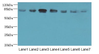 CLGN / Calmegin Antibody - Western blot. All lanes CLGN antibody at 7 ug/ml. Lane 1: Mouse brain tissue. Lane 2: Mouse lung tissue. Lane 3: Jurkat whole cell lysate. Lane 4: HepG-2 whole cell lysate. Lane 5: PC-3 whole cell lysate. Lane 6: HeLa whole cell lysate. Lane 7: HL60 whole cell lysate. Secondary Goat polyclonal to Rabbit IgG at 1:10000 dilution. Predicted band size: 70 kDa. Observed band size: 80 kDa.