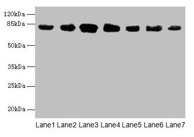 CLGN / Calmegin Antibody - Western blot All lanes: CLGN antibody at 7µg/ml Lane 1: Mouse brain tissue Lane 2: Mouse lung tissue Lane 3: Jurkat whole cell lysate Lane 4: HepG2 whole cell lysate Lane 5: PC-3 whole cell lysate Lane 6: Hela whole cell lysate Lane 7: HL60 whole cell lysate Secondary Goat polyclonal to rabbit IgG at 1/10000 dilution Predicted band size: 71, 47 kDa Observed band size: 80 kDa
