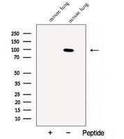 CLGN / Calmegin Antibody - Western blot analysis of extracts of mouse lung tissue using Calmegin antibody. The lane on the left was treated with blocking peptide.