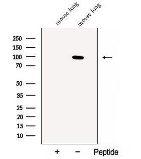 CLGN / Calmegin Antibody - Western blot analysis of extracts of mouse lung tissue using Calmegin antibody. The lane on the left was treated with blocking peptide.