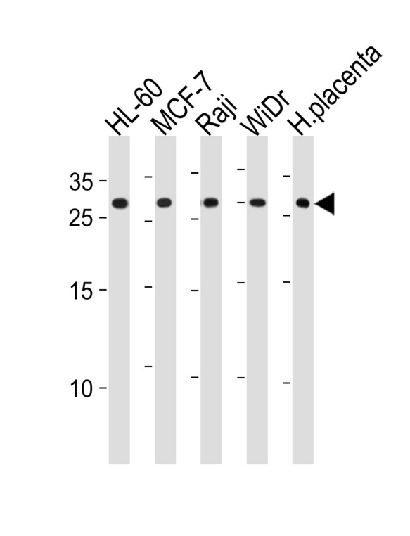 CLIC1 / NCC27 Antibody - CLIC1 Antibody western blot of HL-60, MCF-7, Raji, WiDr cell line and human placenta tissue lysates (35 ug/lane). The CLIC1 antibody detected the CLIC1 protein (arrow).