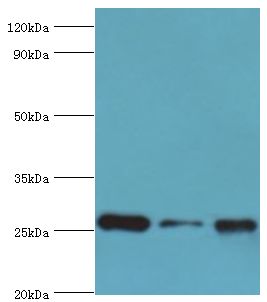 CLIC1 / NCC27 Antibody - Western blot. All lanes: Chloride intracellular channel protein 1 antibody at 4 ug/ml. Lane 1: HeLa whole cell lysate. Lane 2: Jurkat whole cell lysate. Lane 3: MCF7 whole cell lysate. secondary Goat polyclonal to rabbit at 1:10000 dilution. Predicted band size: 27 kDa. Observed band size: 27 kDa.