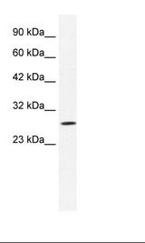 CLIC1 / NCC27 Antibody - Jurkat Cell Lysate.  This image was taken for the unconjugated form of this product. Other forms have not been tested.