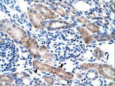 CLIC1 / NCC27 Antibody - CLIC1 antibody ARP35045_T100-NP_001279-CLIC1 (chloride intracellular channel 1) Antibody was used in IHC to stain formalin-fixed, paraffin-embedded human kidney.  This image was taken for the unconjugated form of this product. Other forms have not been tested.
