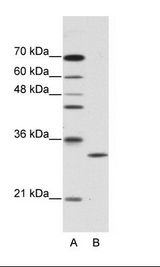 CLIC1 / NCC27 Antibody - A: Marker, B: HepG2 Cell Lysate.  This image was taken for the unconjugated form of this product. Other forms have not been tested.
