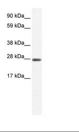 CLIC1 / NCC27 Antibody - Fetal small Intestine Lysate.  This image was taken for the unconjugated form of this product. Other forms have not been tested.