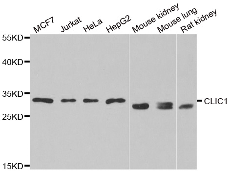 CLIC1 / NCC27 Antibody - Western blot analysis of extracts of various cell lines.