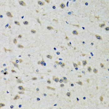 CLIC1 / NCC27 Antibody - Immunohistochemistry of paraffin-embedded rat brain tissue.