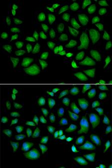 CLIC1 / NCC27 Antibody - Immunofluorescence analysis of HeLa cells.